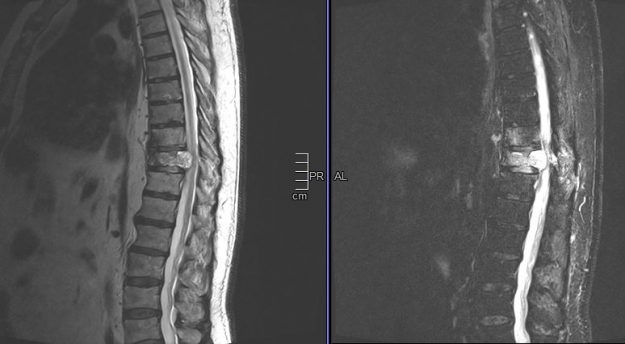 Μαγνητική Θωρακικής Μοίρας