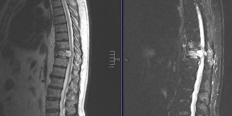 Μαγνητική Θωρακικής Μοίρας