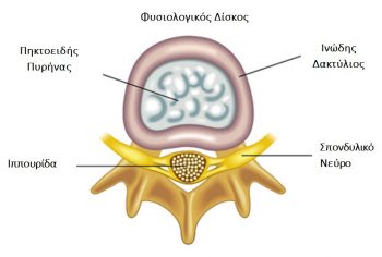 φυσιολογικός δίσκος Φυσιολογικός μεσοσπονδύλιος δίσκος